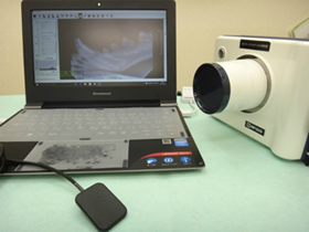 ポータブルX線照射器とデジタル歯科用レントゲンセンサー
